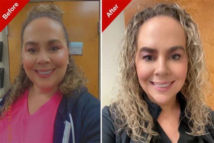 GMA's Ginger Zee shares before-and-after photo following illness - 'It's hard to believe I’m the same person'