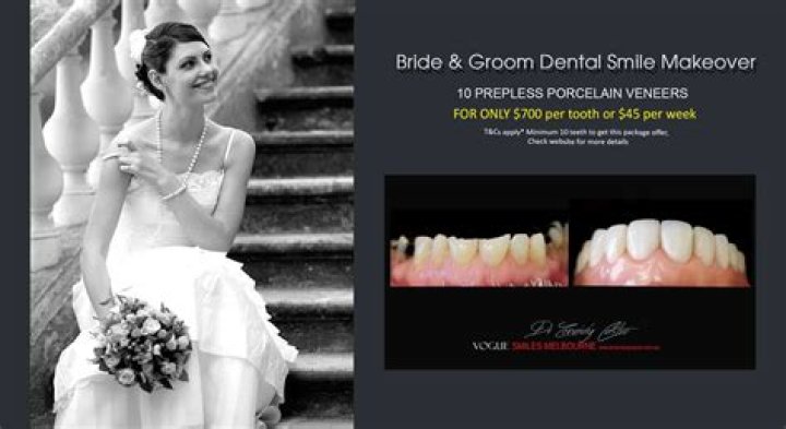 Wedding smile makeover guide: A cosmetic dentist reveals how much it costs to make your teeth look picture perfect